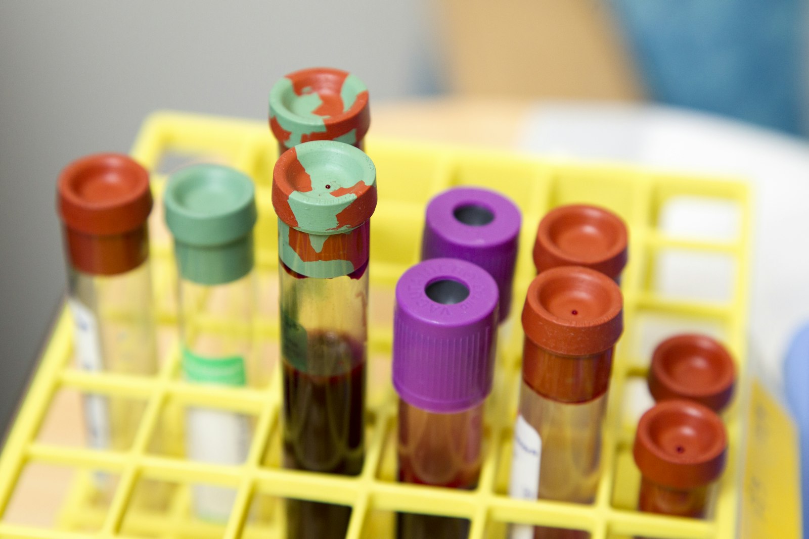 Blood sample tubes with colored caps in a lab rack