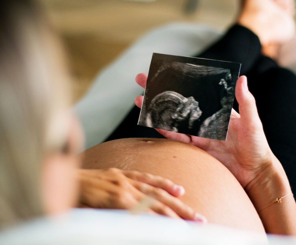 How Often Do Babies Get Hiccups in the Womb? Exploring Fetal Hiccups